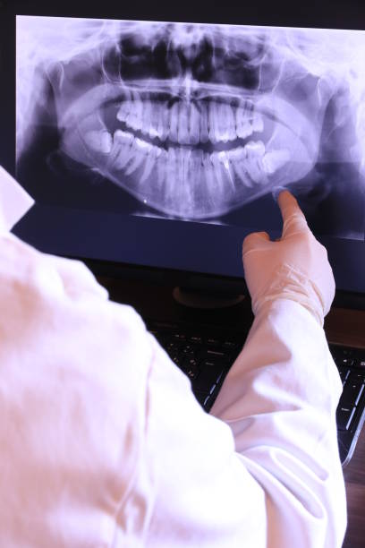 Best Tooth Infection Emergency Dentist  in Evansville, WY