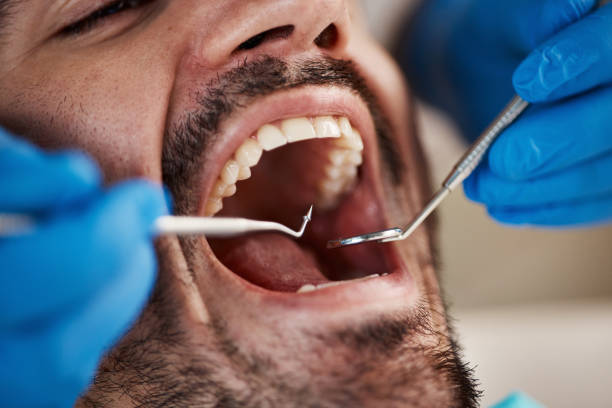 Best Cracked Tooth Emergency Dentist  in Evansville, WY